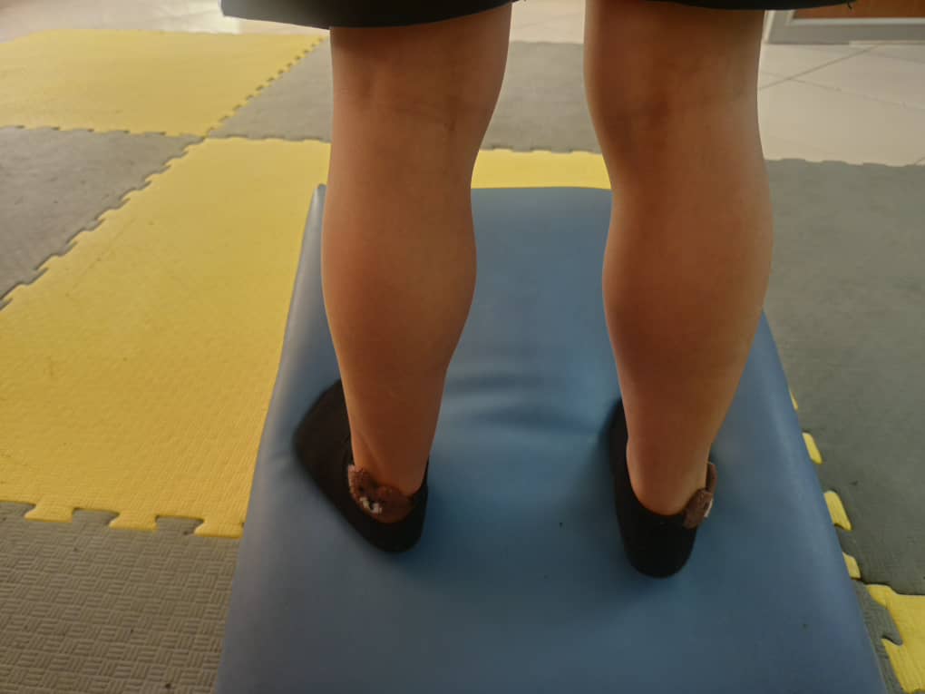 بیماری دوشن یک اختلال ژنتیکی جدی و پیش‌رونده است که با ضعف عضلانی، هایپرتروفی کاذب ساق و علامت گاورز همراه است. تشخیص زودهنگام و شروع درمان‌های حمایتی می‌تواند روند پیشرفت بیماری را کندتر کرده و کیفیت زندگی بیمار را بهبود بخشد.