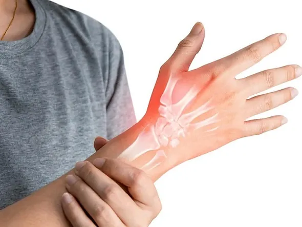 Tennis Elbow و CTS: چالش‌های شایع زنان خانه‌دار و درمان با کاردرمانی دست در مرکز صبا