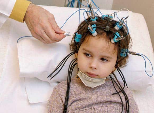 راهنمای کامل تشنج نوزادی: انواع، آسیب‌های مغزی و تمرینات کاردرمانی برای تقویت cognition و حرکت: کاردرمانی صبا