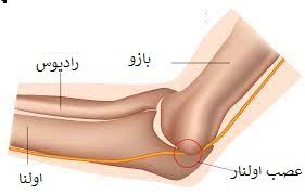 راهنمای درمان دستی در مرکز جامع اولنار، مدیینال و پارگی مرجع در ناحیه اولنار، مدیانه درمانی جامع صبا